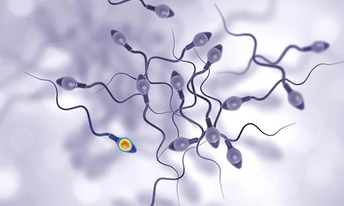 Micro TESE Microsurgical Testicular Sperm