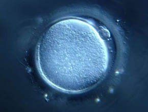 IVF and Infertility