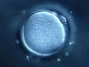 IVF and Infertility