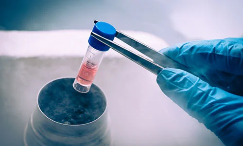 Sperm Cryopreservation Sperm Cryopreservation1