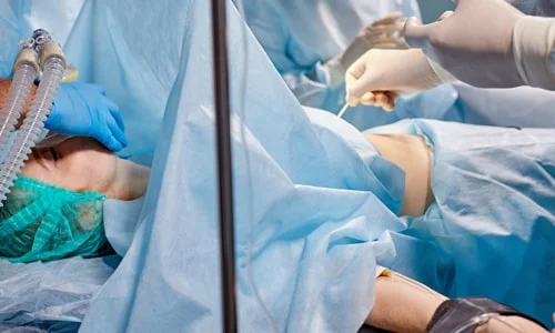 Laparoscopic Sacrocolpopexy