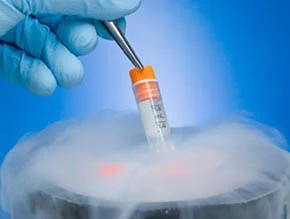 sperm-sryopreservation-min